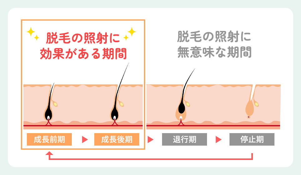 毛周期のと脱毛照射が効果の有無の期間の図説