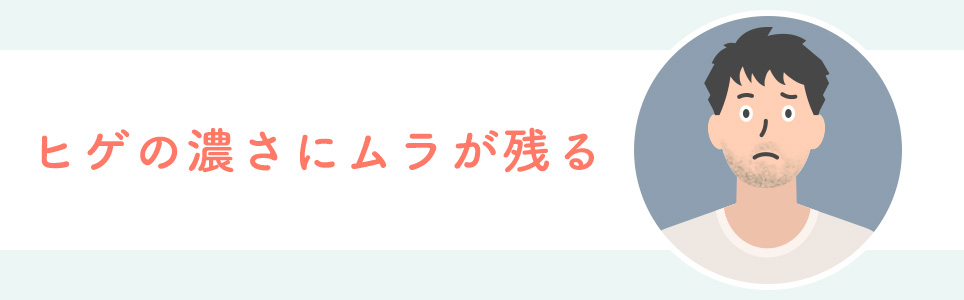 ヒゲの濃さにムラが残る