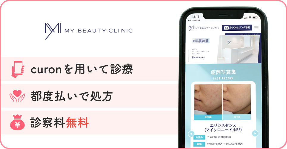 MYビューティークリニックの公式サイトを映したスマホの写真