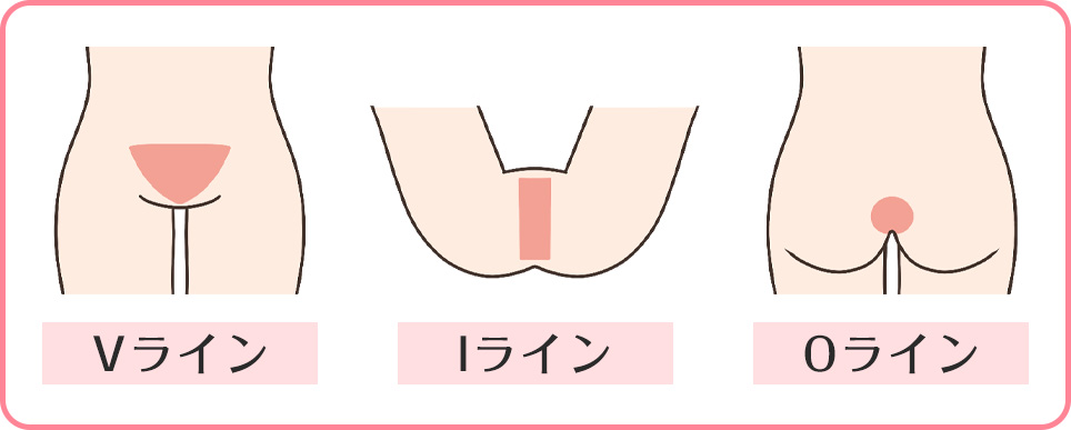 VIO脱毛のパーツの図説