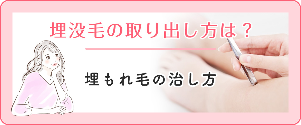埋没毛の治療法