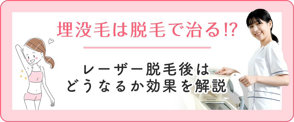 埋没毛のレーザー脱毛後は?