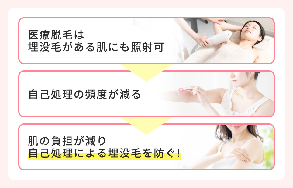医療脱毛と埋没毛