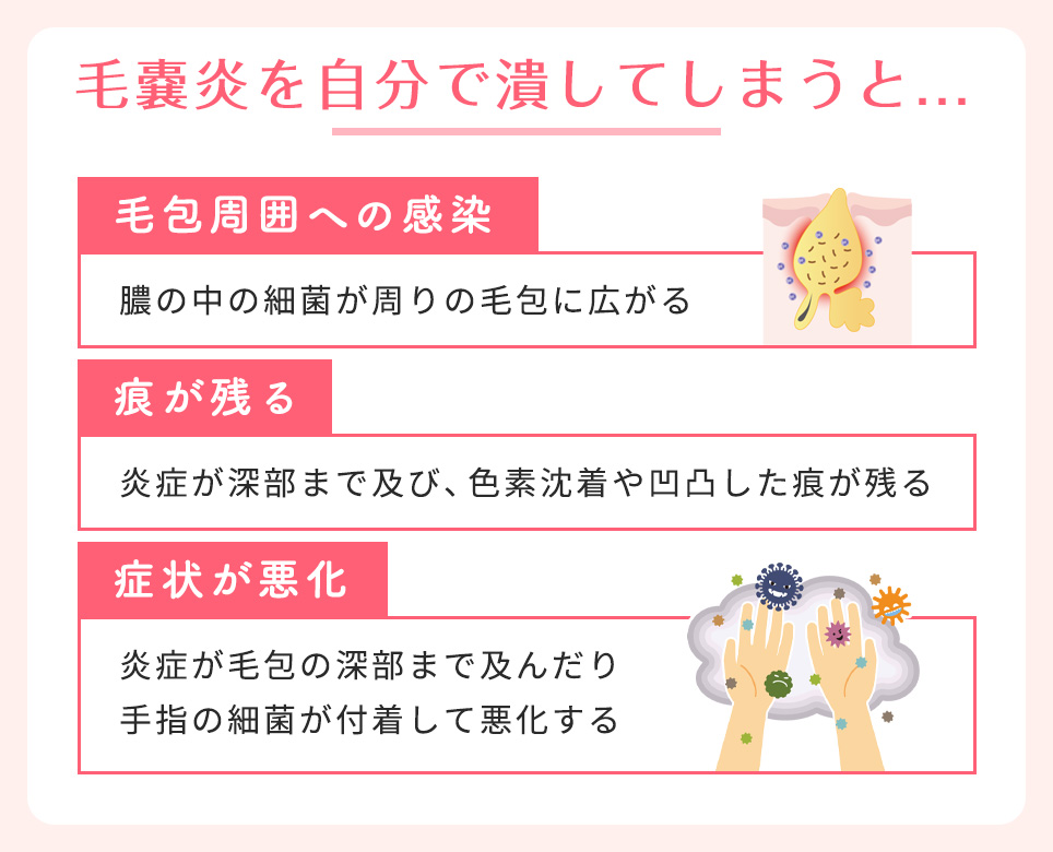毛嚢炎を自分で潰してしまう問題点まとめ