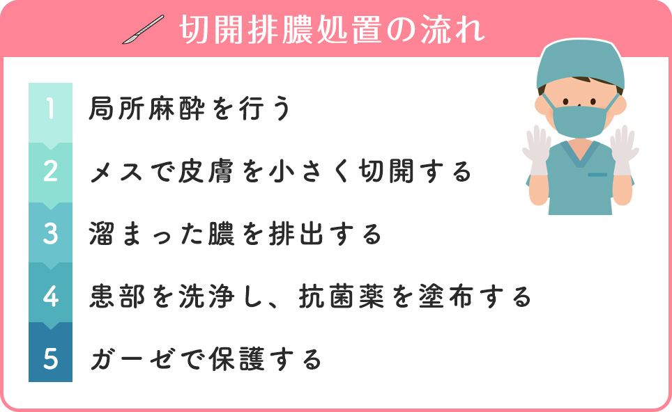 切開排膿処置の流れまとめ