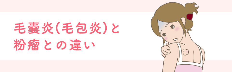 毛嚢炎(毛包炎)と粉瘤との違い