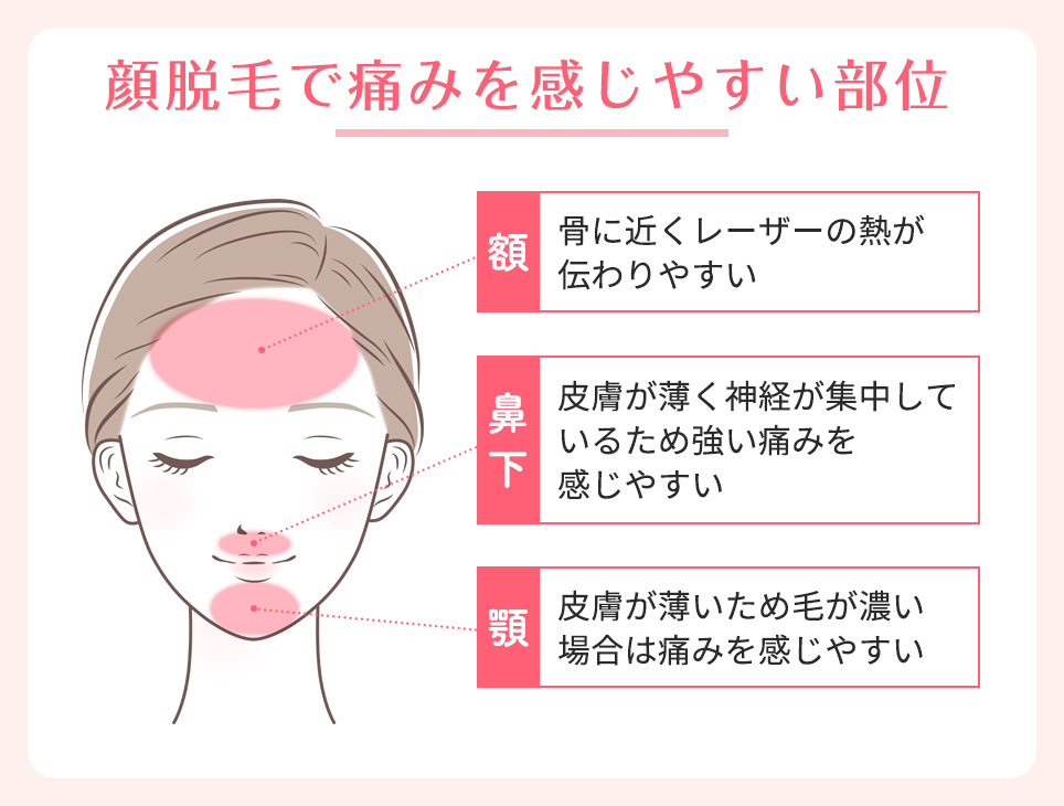 顔脱毛で痛みを感じやすい部位の図説