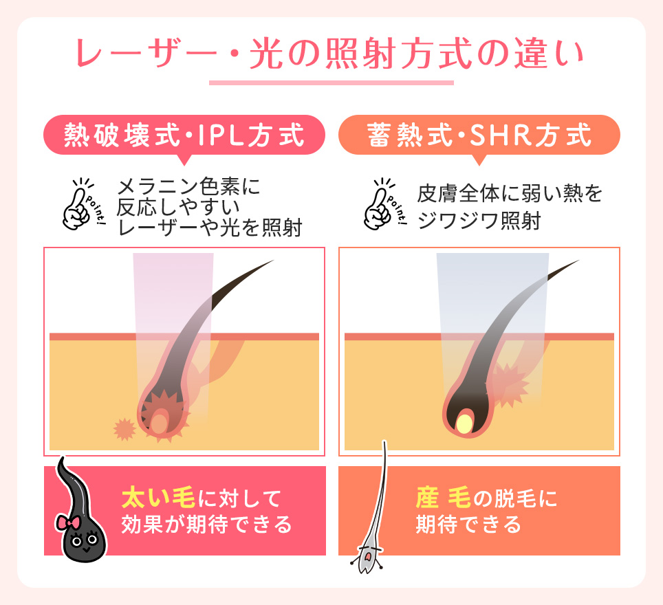 レーザー・光の照射方式の違い一覧