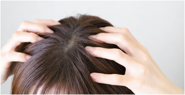 誤ったヘアケアや頭皮環境の悪化